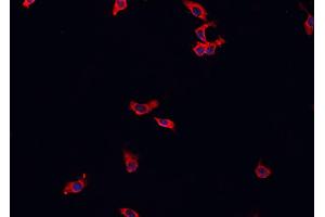ABIN6269244 staining HeLa cells by IF/ICC. (MAP3K8 antibody  (Internal Region))