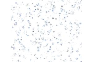 Immunocytochemistry (ICC) image for anti-Zinc Finger E-Box Binding Homeobox 1 (ZEB1) (AA 750-800) antibody (ABIN7455173)