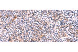Immunohistochemistry of paraffin-embedded Human tonsil tissue using NCAN Polyclonal Antibody at dilution of 1:30(x200) (Neurocan antibody)