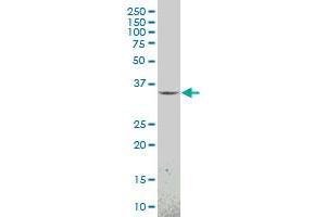MEOX1 monoclonal antibody (M23), clone 1F3 Western Blot analysis of MEOX1 expression in Y-79 .