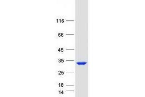 Western Blotting (WB) image for Tubulin Polymerization Promoting Protein (Tppp) protein (Myc-DYKDDDDK Tag) (ABIN2734093)