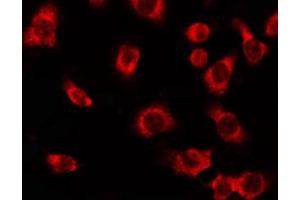 ABIN6274563 staining HepG2 by IF/ICC. (YWHAE antibody  (C-Term))