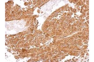 IHC-P Image MRPS5 antibody detects MRPS5 protein at cytosol on AGS xenograft by immunohistochemical analysis. (MRPS5 antibody)