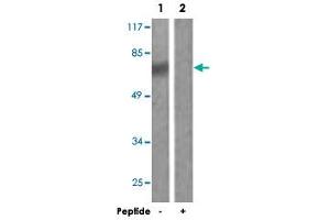Western blot analysis of extracts from HepG2 cells, using DDX3X polyclonal antibody . (DDX3X antibody)
