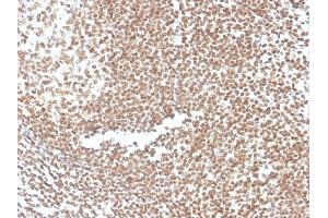 Formalin-fixed, paraffin-embedded human colon stained with P16INK4a Mouse Monoclonal Antibody (CDKN2A/3830). (CDKN2A antibody)
