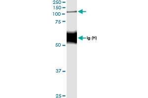 Immunoprecipitation of NOD2 transfected lysate using anti-NOD2 MaxPab rabbit polyclonal antibody and Protein A Magnetic Bead , and immunoblotted with NOD2 MaxPab rabbit polyclonal antibody (D01) . (NOD2 antibody  (AA 1-1040))