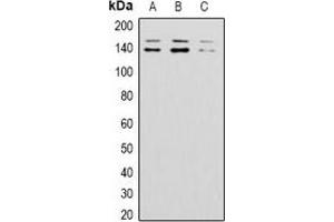 Western blot analysis of BAI1 expression in 293T (A), mouse brain (B), rat brain (C) whole cell lysates.