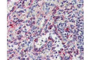 IHC Information: Spleen, Human: Formalin-Fixed, Paraffin-Embedded (FFPE) (CYBB antibody  (C-Term))