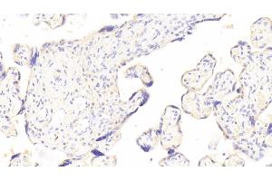 Detection of GM-CSF in Human Placenta Tissue using Polyclonal Antibody to Colony Stimulating Factor 2, Granulocyte Macrophage (GM-CSF) (GM-CSF antibody  (AA 18-144))