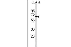 Western blot analysis in Jurkat cell line lysates (35ug/lane). (ZNF358 antibody  (N-Term))