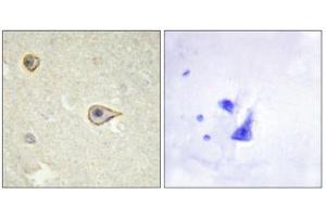 Immunohistochemistry (IHC) image for anti-Cytochrome P450, Family 19, Subfamily A, Polypeptide 1 (CYP19A1) antibody (ABIN1850333)