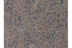 IHC-P analysis of Rat Stomach Tissue, with DAB staining. (EIF2AK2 antibody  (AA 279-506))