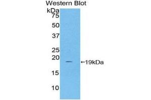 Western Blotting (WB) image for anti-Haptoglobin (HP) (AA 168-319) antibody (ABIN1859196)