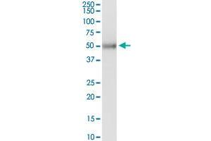 KRT83 MaxPab rabbit polyclonal antibody. (KRT83 antibody  (AA 1-493))