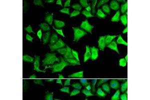 Immunofluorescence analysis of MCF-7 cells using RPS12 Polyclonal Antibody (RPS12 antibody)
