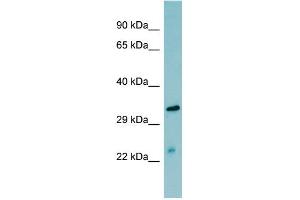 WB Suggested Anti-MASP2  Antibody Titration: 0. (MASP2 antibody  (N-Term))
