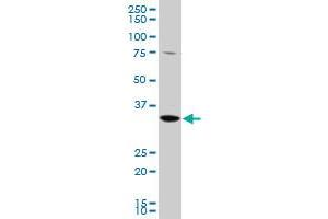 GGPS1 polyclonal antibody (A01), Lot # 051219JC01 Western Blot analysis of GGPS1 expression in K-562 . (GGPS1 antibody  (AA 201-300))