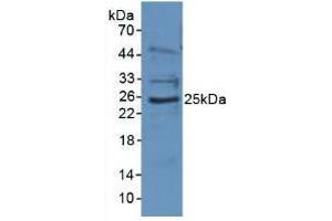 Figure. (EBI3 antibody  (AA 21-229))