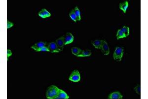 Immunofluorescent analysis of HepG2 cells using ABIN7148593 at dilution of 1:100 and Alexa Fluor 488-congugated AffiniPure Goat Anti-Rabbit IgG(H+L) (Coronin 1a antibody  (AA 363-432))