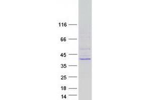 Validation with Western Blot (Nth Endonuclease III-Like 1 (NTHL1) protein (Myc-DYKDDDDK Tag))