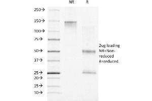 SDS-PAGE Analysis Purified Progesterone Receptor Mouse Monoclonal Antibody (PR500). (Progesterone Receptor antibody)