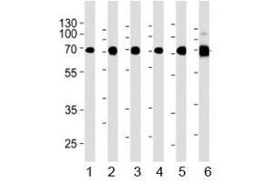 Acetylcholinesterase antibody western blot analysis in 1) human Raji, 2) human Jurkat, 3) human COS7, 4) mouse NIH3T3, 5) mouse cerebellum, and 6) rat cerebellum lysate. (Acetylcholinesterase antibody  (AA 587-611))