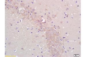 Formalin-fixed and paraffin embedded rat brain labeled with Rabbit Anti CYP19/CYP19A1 Polyclonal Antibody, Unconjugated (ABIN674529) at 1:200 followed by conjugation to the secondary antibody and DAB staining (Aromatase antibody  (AA 41-140))