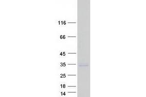 Western Blotting (WB) image for Prostate Transmembrane Protein, Androgen Induced 1 (PMEPA1) (Transcript Variant 3) protein (Myc-DYKDDDDK Tag) (ABIN2729206)