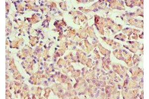 Immunohistochemistry of paraffin-embedded human pancreatic tissue using ABIN7155744 at dilution of 1:100 (HOXB7 antibody  (AA 1-120))
