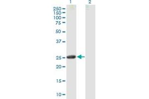 Western Blot analysis of CNTF expression in transfected 293T cell line by CNTF MaxPab polyclonal antibody. (CNTF antibody  (AA 1-200))