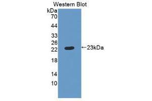 Western blot analysis of recombinant Human RBP4.