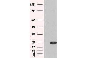 Image no. 1 for anti-Adenylate Kinase 1 (AK1) antibody (ABIN1496515) (Adenylate Kinase 1 antibody)