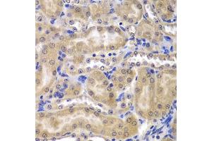 Immunohistochemistry of paraffin-embedded mouse kidney using RPL5 antibody (ABIN3015785, ABIN3015786, ABIN3015787 and ABIN6219135) at dilution of 1:200 (40x lens).