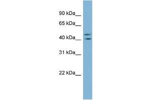 WB Suggested Anti-ZNF517 Antibody Titration:  0. (ZNF517 antibody  (Middle Region))