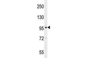 BRDT western blot analysis in MDA-MB435 lysate (BRDT antibody  (AA 1-30))