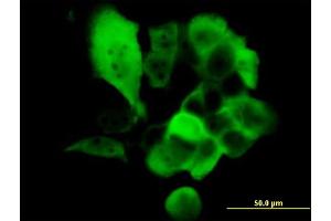 Immunofluorescence of monoclonal antibody to S100A2 on A-431 cell. (S100A2 antibody  (AA 1-97))