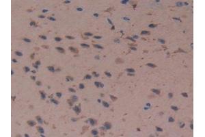 Detection of Cys-C in Mouse Cerebrum Tissue using Polyclonal Antibody to Cystatin C (Cys-C) (CST3 antibody  (AA 21-140))