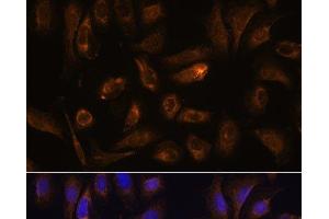 Immunofluorescence analysis of U-2 OS cells using RGS4 Polyclonal Antibody at dilution of 1:100. (RGS4 antibody)