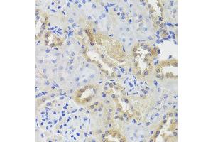 Immunohistochemistry of paraffin-embedded rat kidney using CTSC antibody at dilution of 1:100 (x40 lens). (CTSC antibody)