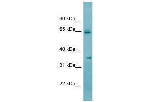 WB Suggested Anti-KHK Antibody Titration:  0.