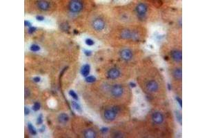 Used in DAB staining on fromalin fixed paraffin-embedded Liver tissue (IFNA21 antibody  (AA 25-189))