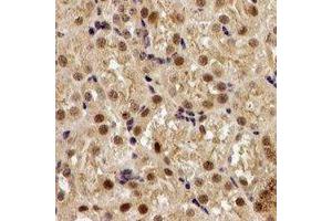 Immunohistochemical analysis of EGLN1 staining in human kidney formalin fixed paraffin embedded tissue section. (EGLN1 antibody)