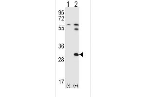 Western blot analysis of STAP1 using rabbit polyclonal STAP1 Antibody (F56) using 293 cell lysates (2 ug/lane) either nontransfected (Lane 1) or transiently transfected (Lane 2) with the STAP1 gene. (STAP1 antibody  (N-Term))