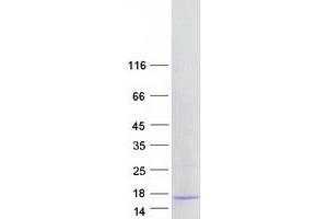 Validation with Western Blot (ABRACL/C6orf115 Protein (Myc-DYKDDDDK Tag))