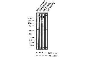 Western blot analysis of Phospho-ATF2 (Ser112 or 94) expression in various lysates (ATF2 antibody  (pSer94, pSer112))