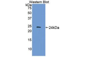 Western blot analysis of the recombinant protein. (ADCY7 antibody  (AA 309-491))