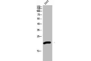Western Blot analysis of 293T cells using ZNF695 Polyclonal Antibody (ZNF695 antibody  (Internal Region))
