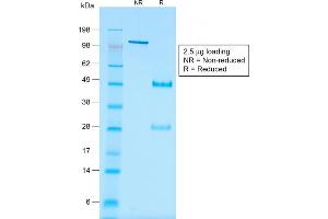 SDS-PAGE Analysis of Purified WT1 Mouse Recombinant Monoclonal Antibody ABIN6383829. (Recombinant WT1 antibody)
