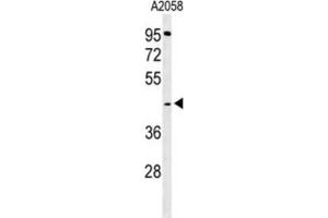 Western Blotting (WB) image for anti-Trans-2,3-Enoyl-CoA Reductase (TECR) antibody (ABIN3004322)