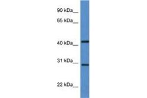 Image no. 1 for anti-Alkaline Ceramidase 1 (ACER1) (C-Term) antibody (ABIN6746914) (ACER1 antibody  (C-Term))